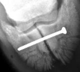 February XRAY DP60