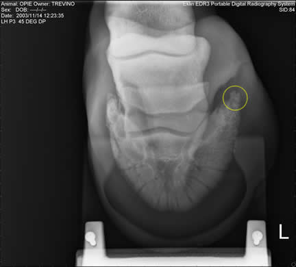 coffin bone fracture