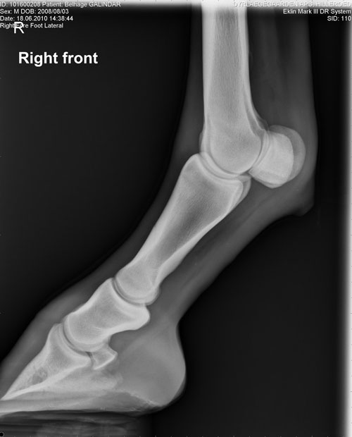 radiograph