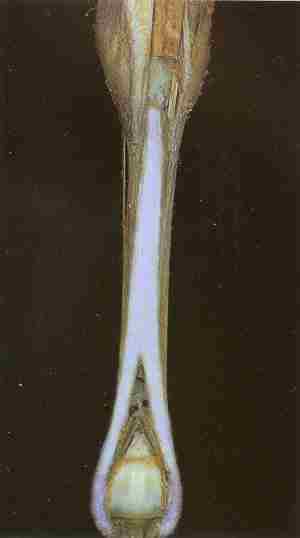 Suspensory Ligament (blue) Posterior View